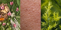 Pores dilats : pourquoi et comment les resserrer naturellement